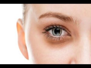 cách che thâm mắt hiệu quả