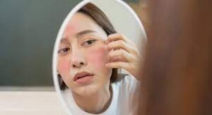 chăm sóc da nhạy cảm khi makeup