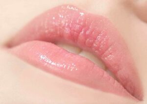 che khuyết điểm môi thâm