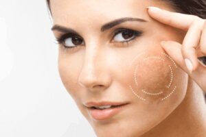 che mụn bằng kem nền