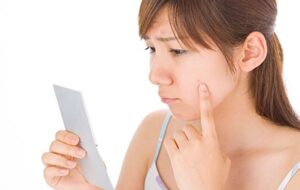 che mụn sưng đỏ khi makeup 