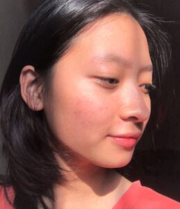 che mụn sưng đỏ khi makeup 