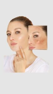 mẹo makeup che khuyết điểm