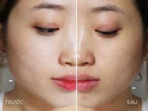 dưỡng da sau khi thức dậy