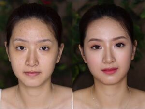 makeup nhẹ nhàng cho da mụn