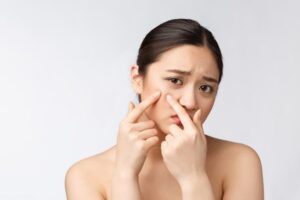 Makeup da mụn