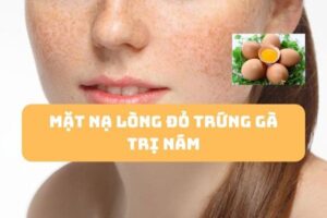 Mặt nạ từ trứng gà