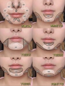 nâng mũi bằng contour