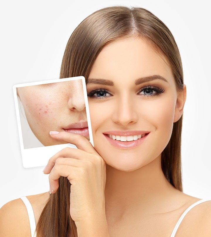 cham-soc-da-mun-truoc-makeup