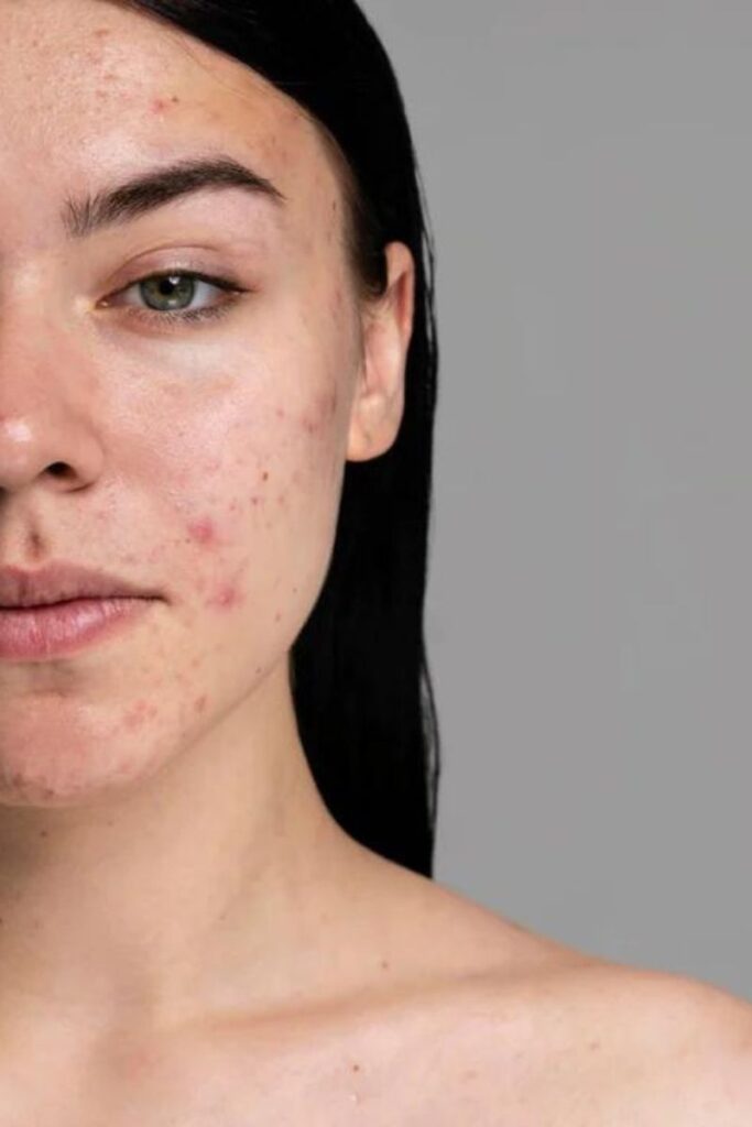 chăm sóc da nhạy cảm makeup
