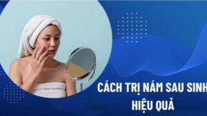 làm đẹp sau sinh tự nhiên