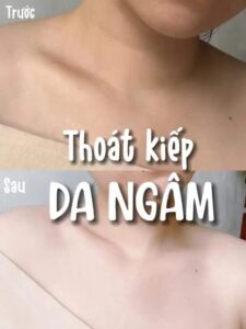 làm đẹp tuổi dậy thì