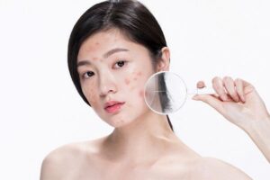 makeup cho người mới da mụn