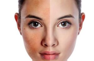 phục hồi da sau makeup