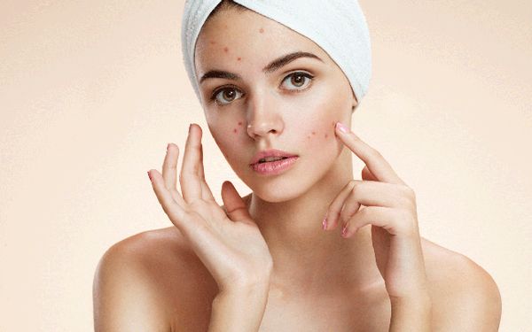 phục hồi da sau makeup