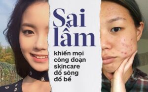 sai lầm khi tẩy trang
