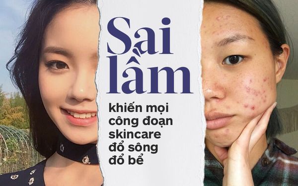 sai lầm khi tẩy trang
