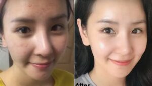 skincare phục hồi sau makeup