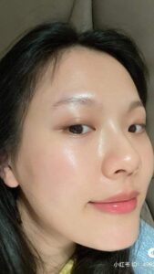 skincare tối cho da mụn